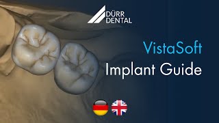 VistaSoft Implant amp Guide [upl. by Anolla981]