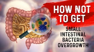 How to STOP Small Intestine Bacterial OvergrowthSIBO – Dr Berg [upl. by Nnyllatsyrc]