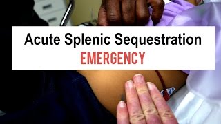 Sickle Cell Splenic Sequestration Emergency [upl. by Irtimid]