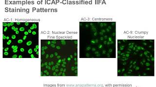 Antinuclear Antibody Testing [upl. by Yticilef146]