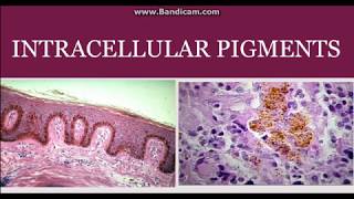 Intracellular pigments [upl. by Galliett]