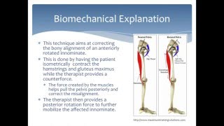 Mobilization to correct an Anterior Innominate rotation of the pelvis Physical Therapy [upl. by Ahsilat]